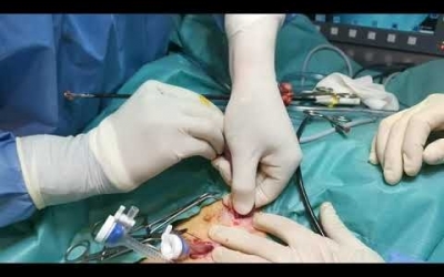 Momento en cirugía endoscópica clínica Veterinaria Plaiaundi