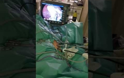 Momento en cirugía endoscópica clínica Veterinaria Plaiaundi